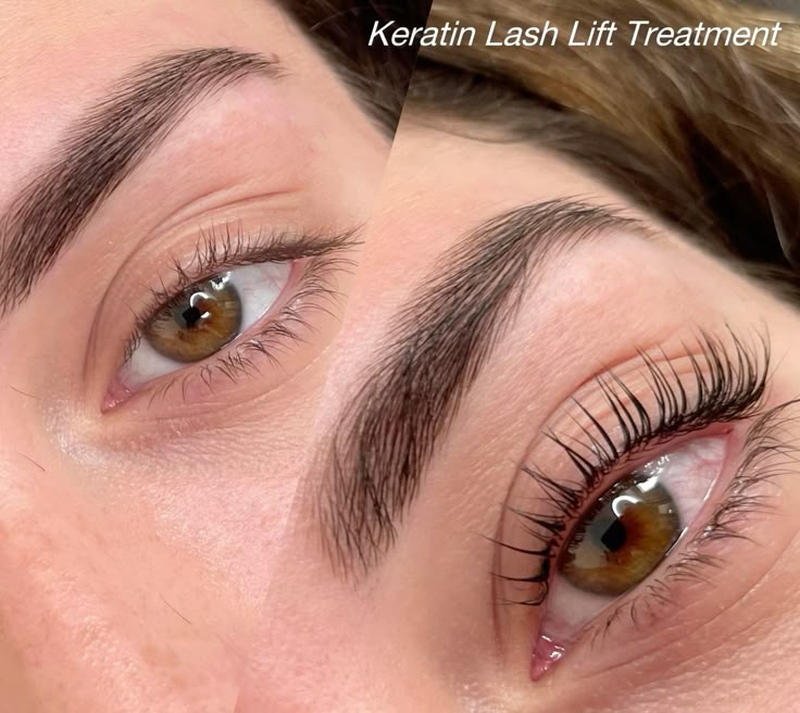 Lash Lift
