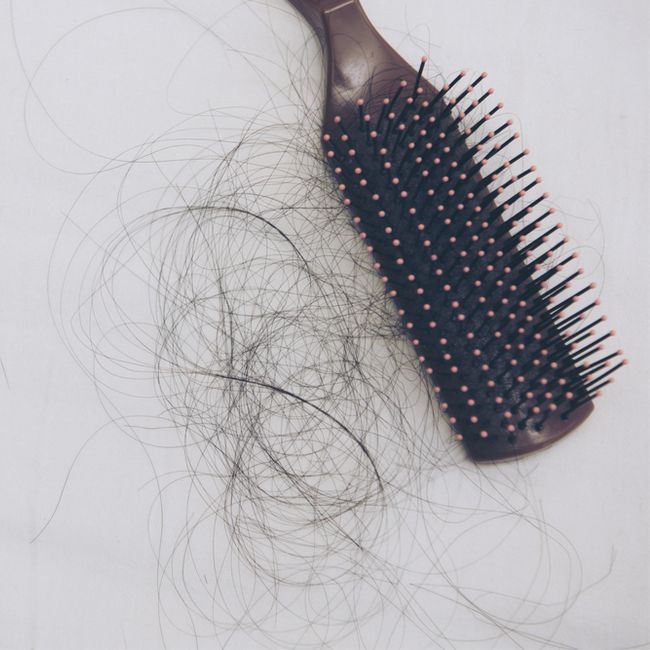 does creatine cause hair loss