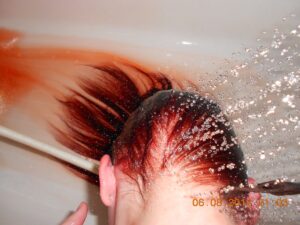 how to get hair dye off skin